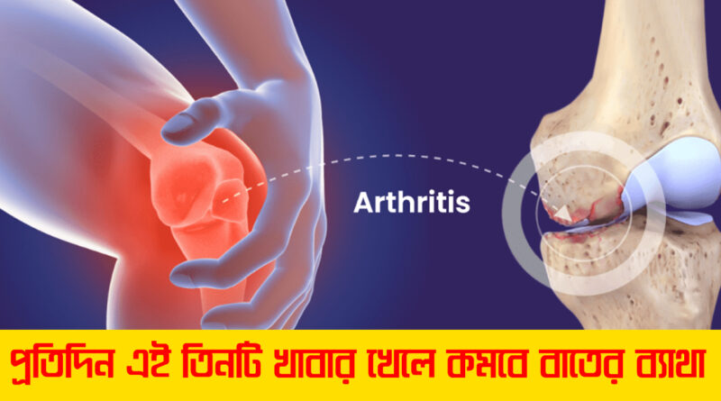 Health Tips Arthritis