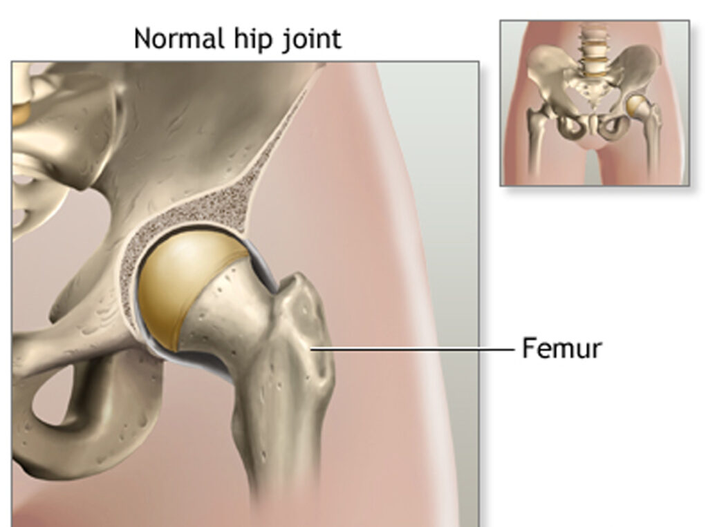 Health Tips Arthritis