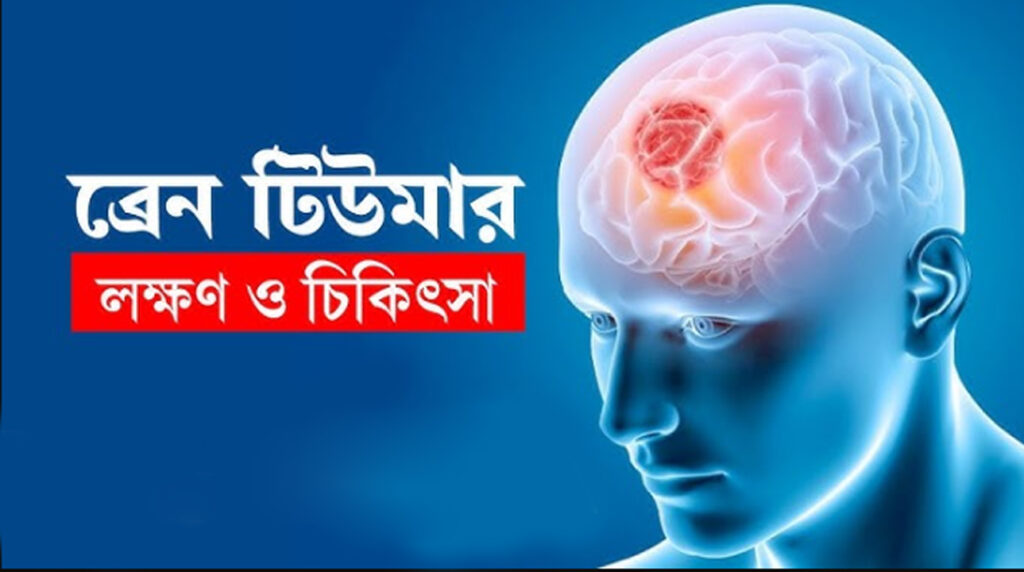 brain tumor cause treatment