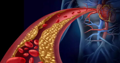 High Cholesterol: উচ্চ কোলেস্টেরলের মাত্রা, লক্ষণ, কারণ, চিকিৎসা এবং কমানোর ঘরোয়া উপায়
