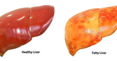 Fatty liver: ফ্যাটি লিভার, এই এক পানীয়ে ফ্যাটি লিভার অ্যারেস্ট, জেনে নিন কখন খাবেন