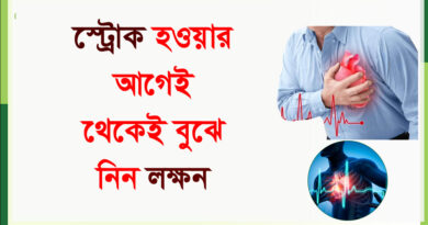 Stroke - Symptoms: স্ট্রোকের এই প্রাথমিক লক্ষণগুলি ভুলেও অবহেলা নয়, সতর্ক করলেন চিকিৎসক